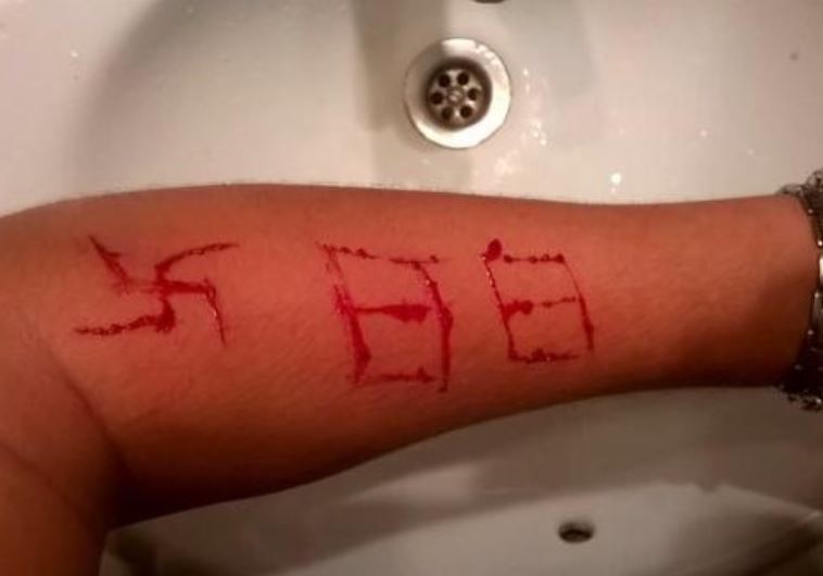 Neo-Nazi gang attacks Spanish teen, carves swastika into arm - Diaspora